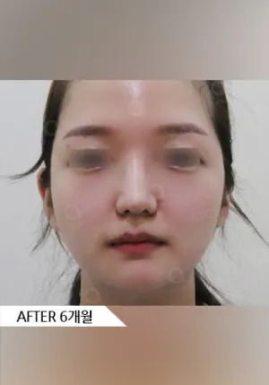After