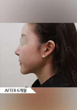 After