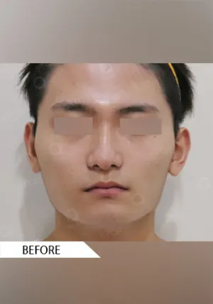 Before