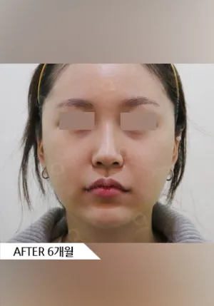 After