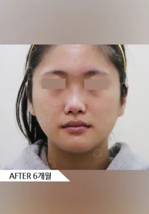 After