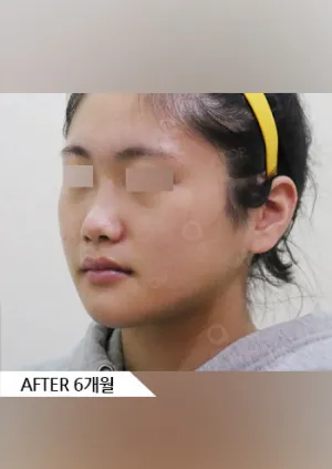 After