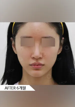 After
