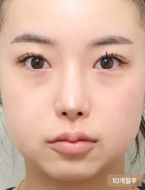 After
