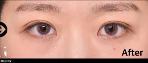 After