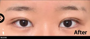 After