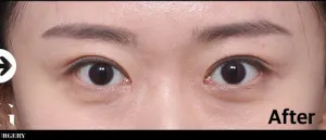 After