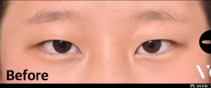 Before