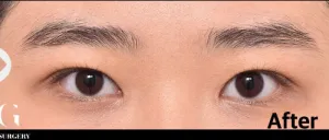 After