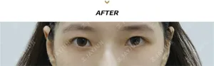 After