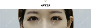 After