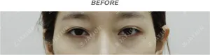 Before