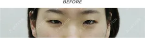 Before