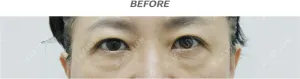 Before