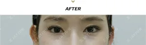After