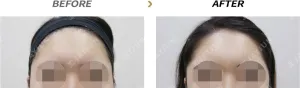 Before