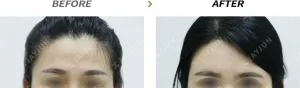 Before
