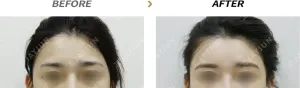 Before