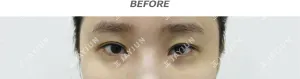 Before