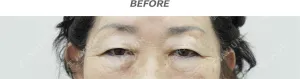 Before