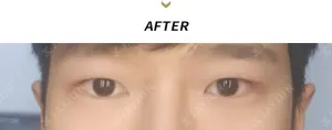 After