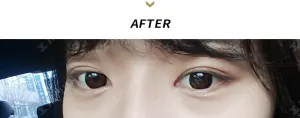 After