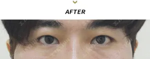 After