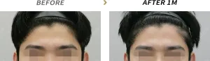 Before