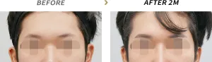 Before