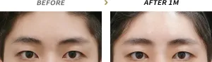 Before