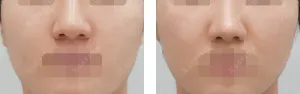 After