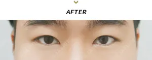 After