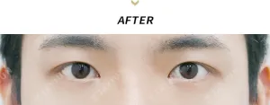 After