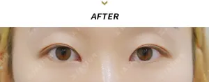 After