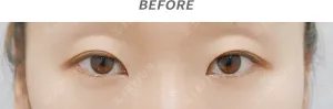 Before