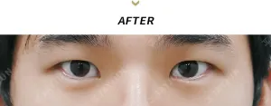 After