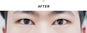 After