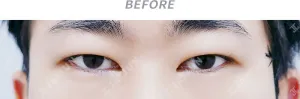 Before
