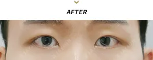After