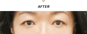 After