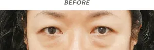 Before