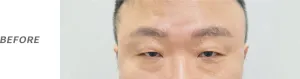 Before