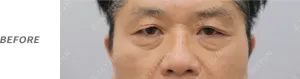 Before