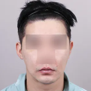 Before