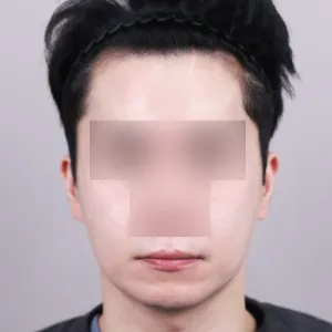 After