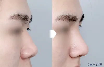 Before & After