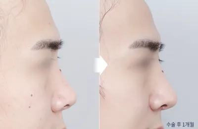 Before & After