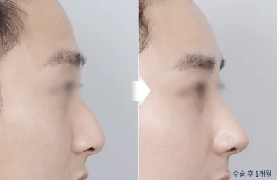 Before & After