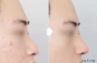 Before & After
