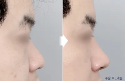 Before & After